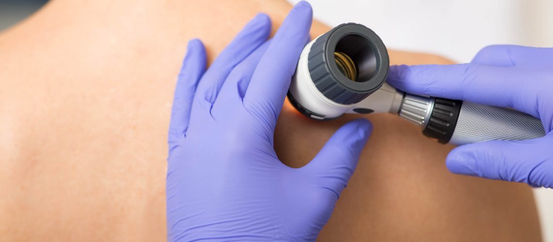 Doctor examining patient skin moles with dermoscope